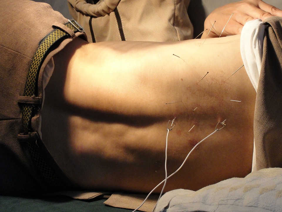 akupunktura białystok